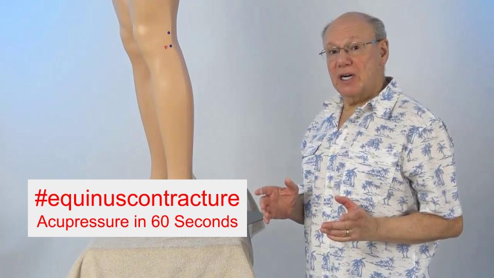 #equinuscontracture - Acupressure in 60 Seconds
