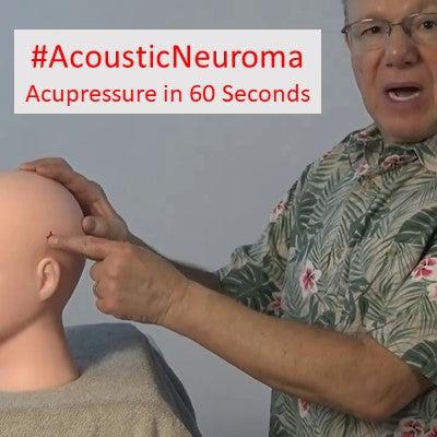 #AcousticNeuroma - Acupressure in 60 Seconds