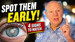 Early Cataract Symptoms Most People Miss