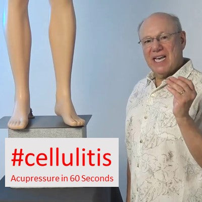 #cellulitis - Acupressure in 60 Seconds