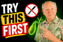 Don’t Rush Gallbladder Removal — Three Ways to Keep It