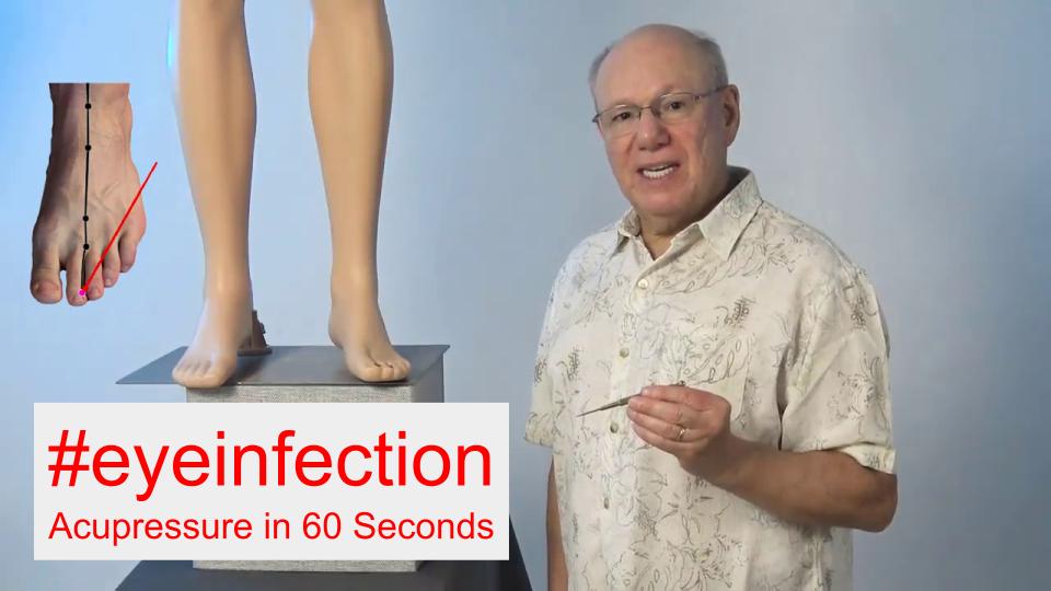 #eyeinfection - Acupressure in 60 Seconds
