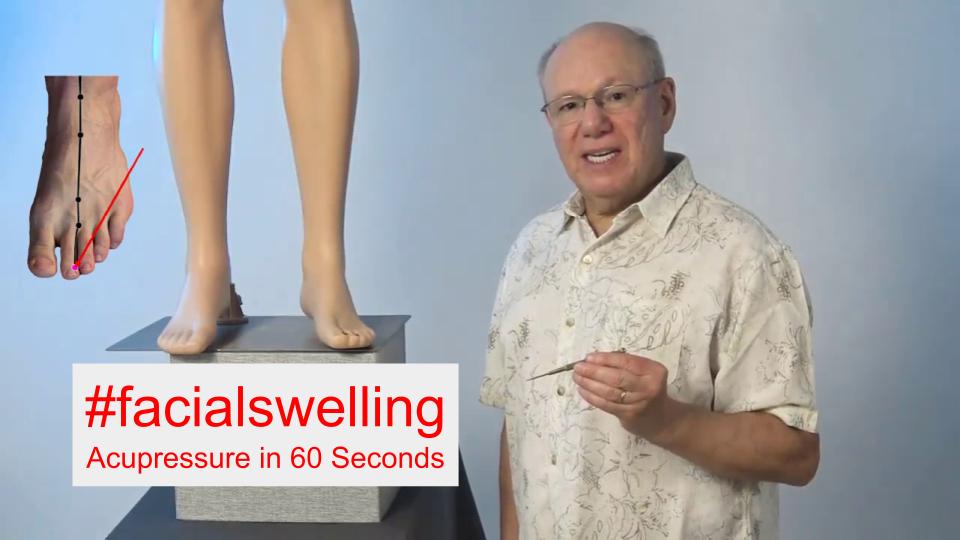 #facialswelling - Acupressure in 60 Seconds
