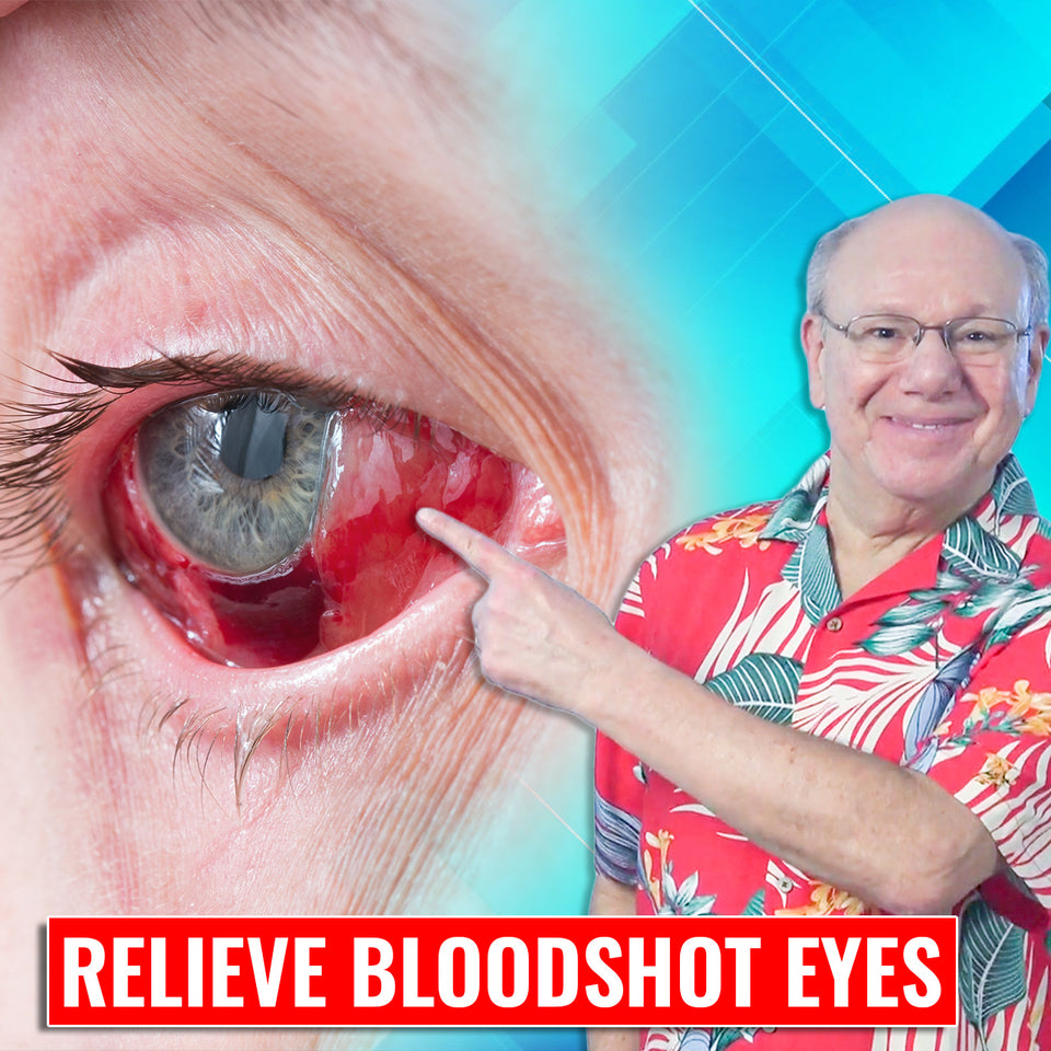 Relieve Bloodshot Eyes